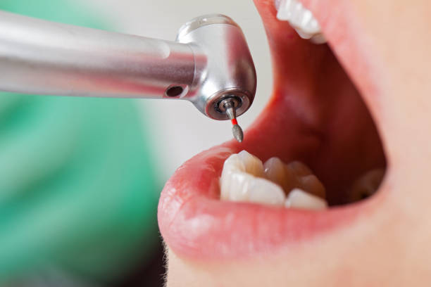 Best Emergency Cosmetic Dentistry (e.g., broken veneers) in Victor, ID